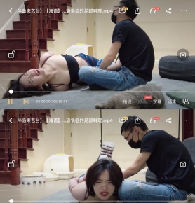 뵺̨YT1067 ǿ֢+ܼ־֢㲿